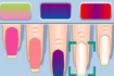 Thumbnail of Nail Fashion Manicure